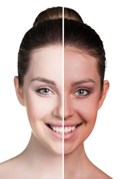 Dark Skin and Uneven Skin Tone - Nutrixia Food
